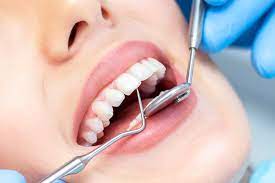 La rubrica di ADM Magenta.  “Denti fissi in 24 ore, bufala o verità?”
