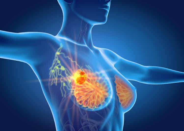 Nuovo farmaco anticancro al seno, lo IEO di Milano: ne aumenteremo l’uso