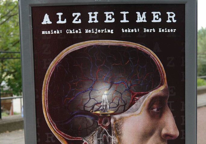 Alzheimer: Irccs Fatebenefratelli, un nuovo balzo nella diagnosi