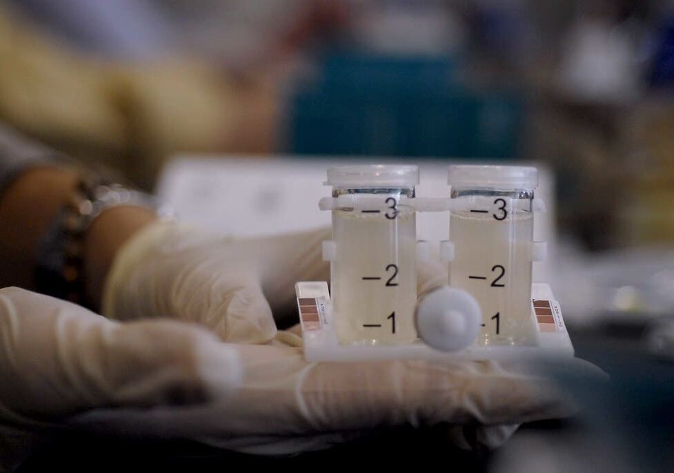 Corsico-Buccinasco, dieci casi di legionella
