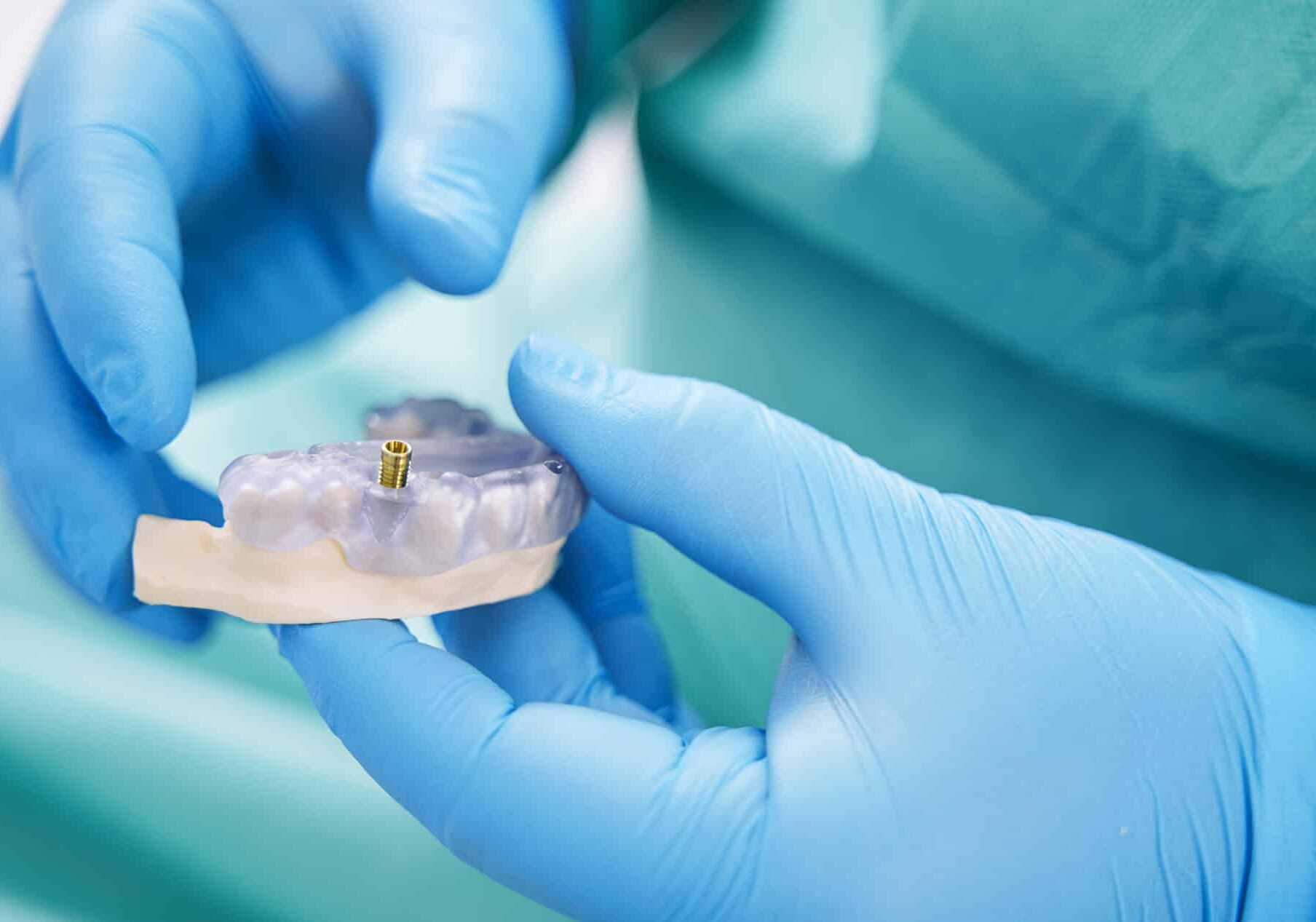 Regione Lombardia: dentiere gratis per malati oncologici e operati al cavo orale