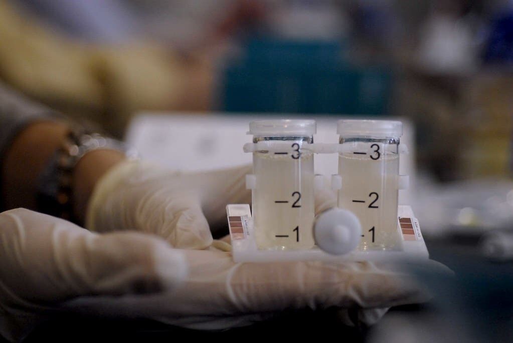 L’epidemia silenziosa di legionella, il punto con l’esperto
