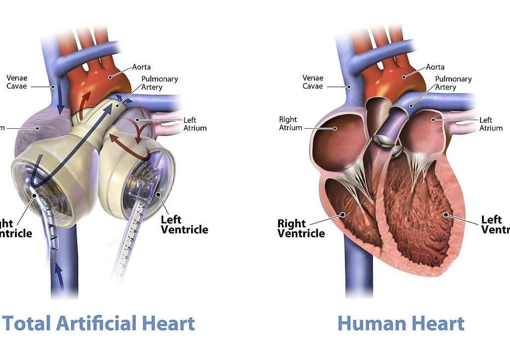 Trapiantare un cuore nuovo? Servono 3 anni e 7 mesi di attesa
