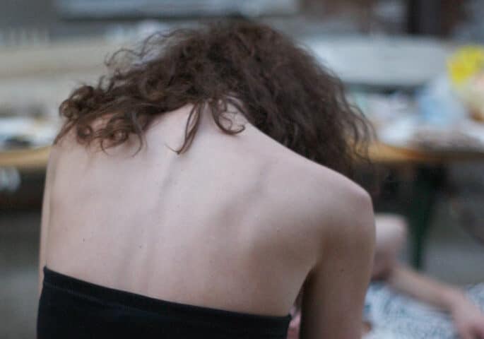 540mila donne italiane colpite da anoressia