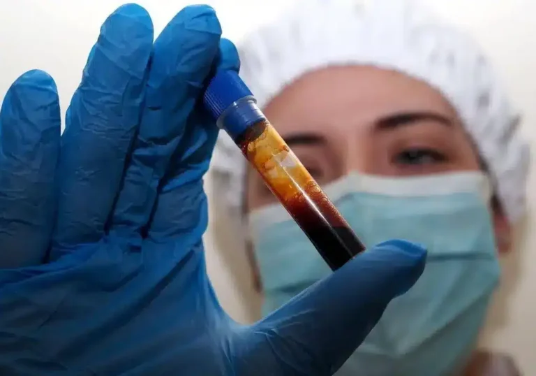 Turista inglese, contatto di caso, in quarantena all’ospedale Sacco