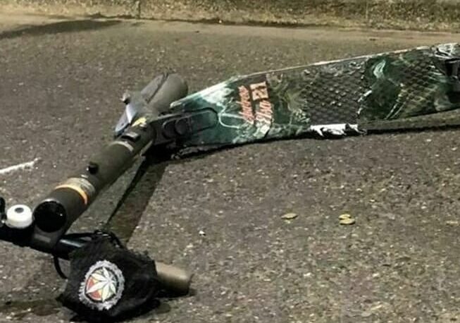 Incidente in monopattino a Milano, migliorano le condizioni del ragazzo